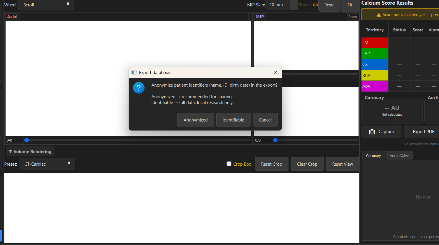 Export del database in CSV