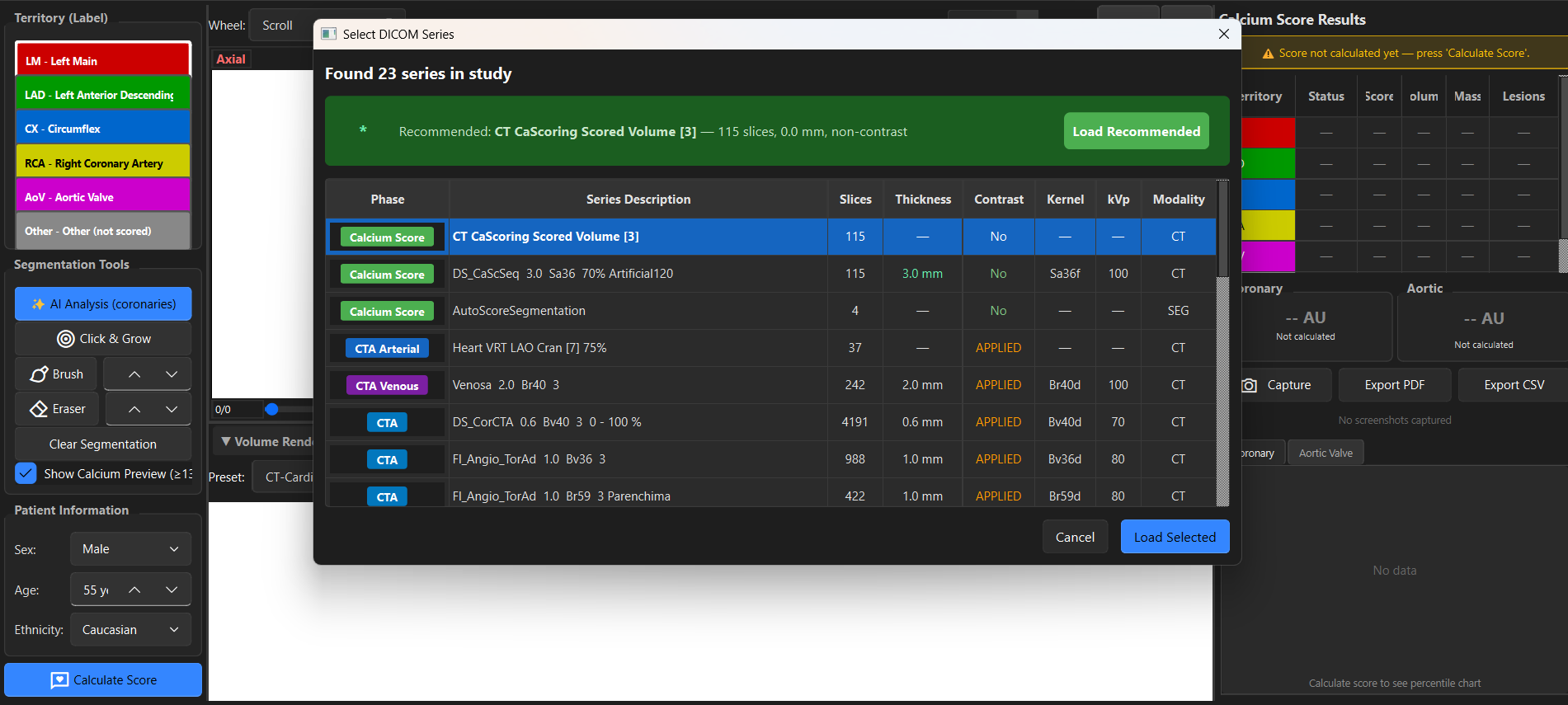 Series Selection Dialog