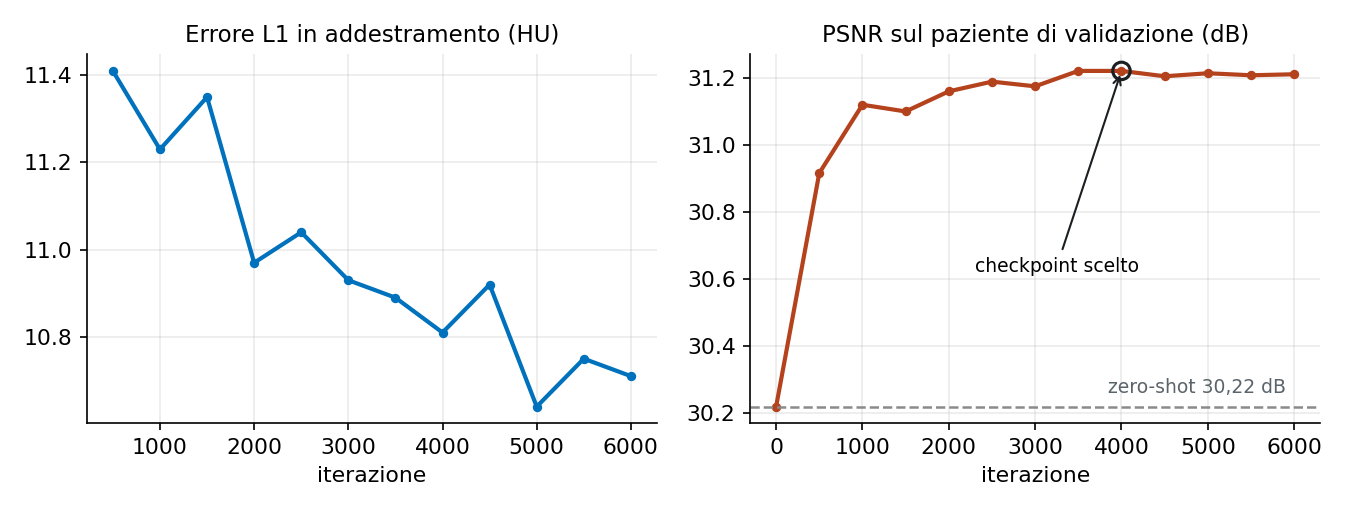 Curve di addestramento: errore L1 in calo da 11,4 a 10,7 HU e PSNR di validazione da 30,22 a 31,22 dB