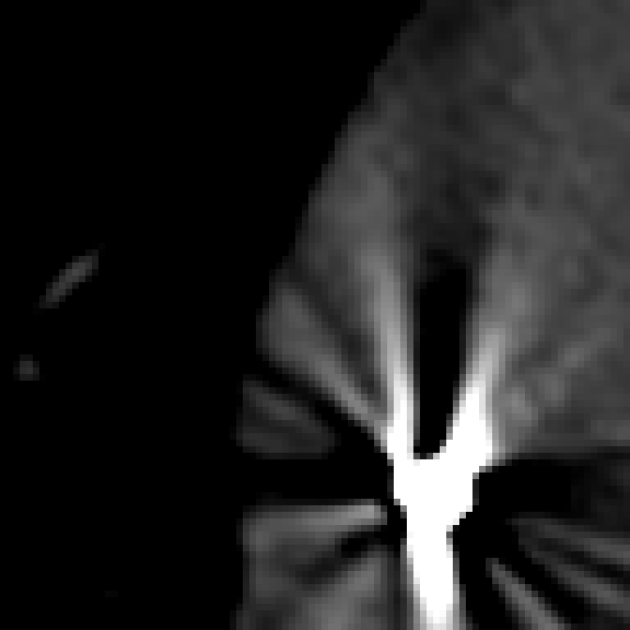 Bicubica — Elettrocatetere, slice 225, W1800 L600, 40 × 40 mm.