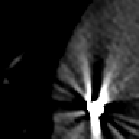 SwinIR — Elettrocatetere, slice 225, W1800 L600, 40 × 40 mm.