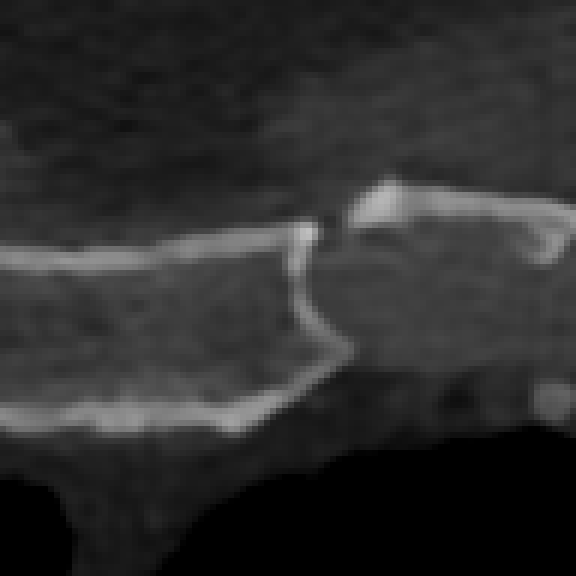 SwinIR — Sterno, slice 375, W1800 L600, 40 × 40 mm.