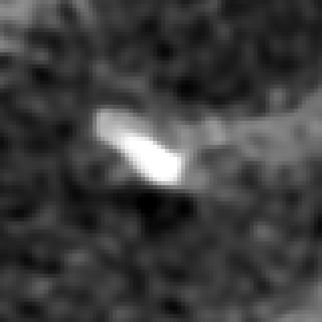 1024 SwinIR — Un crop zoomato molto spinto di una calcificazione coronarica vista da vicino (16,6 × 16,6 mm). A sinistra la ricostruzione Bv44 a 512, a destra la stessa immagine portata a 1024 da SwinIR. Il pulsante mette a destra la bicubica a 1024: stessi pixel in più, ma nessun dettaglio nuovo. Finestra: W1200 L400.